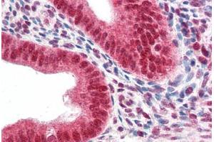 Human Uterus (formalin-fixed, paraffin-embedded) stained with CBX5 antibody ABIN337121 at 2. (CBX5 Antikörper  (AA 88-102))