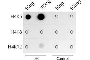 Dot-blot analysis of all sorts of peptides using Acetyl-Histone H4-K5 antibody (ABIN7267743) at 1:1000 dilution. (Histone H4 Antikörper  (acLys5))