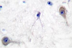 Image no. 1 for anti-Patched 1 (PTCH1) antibody (ABIN271777) (Patched 1 Antikörper)