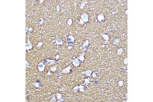 Immunohistochemistry (IHC) image for anti-Synaptosomal-Associated Protein, 25kDa (SNAP25) (AA 1-206) antibody (ABIN3021232)
