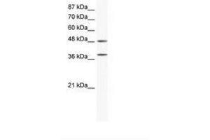Image no. 1 for anti-Mitogen-Activated Protein Kinase 14 (MAPK14) (C-Term) antibody (ABIN203076) (MAPK14 Antikörper  (C-Term))