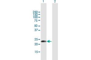 Western Blot analysis of EDN1 expression in transfected 293T cell line by EDN1 MaxPab polyclonal antibody. (Endothelin 1 Antikörper  (AA 1-212))