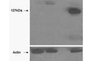 Western Blotting (WB) image for anti-Tankyrase, TRF1-Interacting Ankyrin-Related ADP-Ribose Polymerase 2 (TNKS2) (Internal Region) antibody (ABIN2464159)