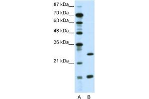 WB Suggested Anti-CEBPG Antibody Titration:  0. (CEBPG Antikörper  (N-Term))