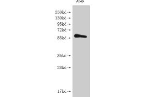 Western blot All lanes: IFNLR1 antibody at 3. (IL28RA Antikörper  (AA 21-228))