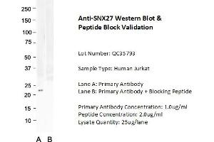 Host: Rabbit Target Name: SNX27 Sample Type: Human Jurkat  Lane A: Primary Antibody  Lane B: Primary Antibody + Blocking Peptide  Primary Antibody Concentration: 1. (SNX27 Antikörper  (C-Term))