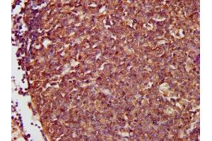 Immunohistochemistry (IHC) image for anti-Nuclear Factor of kappa Light Polypeptide Gene Enhancer in B-Cells 1 (NFKB1) (AA 1-961) antibody (ABIN7161781)