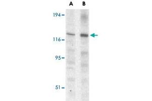 Western blot analysis of Casp12 (small) in mouse (lane A) and rat (lane B) liver lysate with Casp12 small polyclonal antibody  at 1 ug/mL . (Caspase 12 Antikörper)
