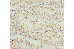 Immunohistochemistry (IHC) image for anti-Optic Atrophy 3 (Autosomal Recessive, with Chorea and Spastic Paraplegia) (OPA3) (AA 25-179) antibody (ABIN7162248)