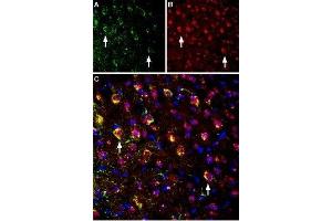 Multiplex staining of NMDAR1 and M4 muscarinic acetylcholine receptor in mouse parietal cortex - Immunohistochemical staining of immersion-fixed, free floating mouse brain frozen sections using rabbit Anti-CHRM4 Antibody (ABIN7043064, ABIN7044584 and ABIN7044585), (1:400) and Guinea pig Anti-NMDAR1 (GluN1) (extracellular) Antibody (ABIN7043243, ABIN7045402 and ABIN7045403), (1:1200).