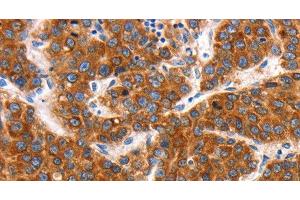 Immunohistochemistry (Paraffin-embedded Sections) (IHC (p)) image for anti-Potassium Voltage-Gated Channel, Shaw-Related Subfamily, Member 2 (KCNC2) antibody (ABIN7242239)