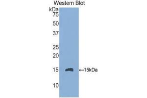 Western Blotting (WB) image for anti-Endoglin (ENG) (AA 336-450) antibody (ABIN1174025) (Endoglin Antikörper  (AA 336-450))