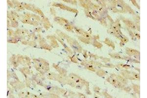 Immunohistochemistry of paraffin-embedded human heart tissue using ABIN7144868 at dilution of 1:100 (ATP5O Antikörper  (AA 24-213))