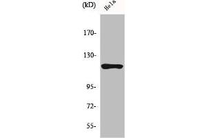 Western Blot analysis of HeLa cells using HXK I Polyclonal Antibody (Hexokinase 1 Antikörper  (N-Term))