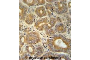 Immunohistochemistry (IHC) image for anti-Cellular Retinoic Acid Binding Protein 1 (CRABP1) antibody (ABIN3002339) (CRABP1 Antikörper)