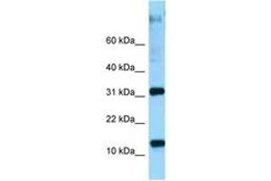 Image no. 1 for anti-Ribosomal Protein L22 (RPL22) (AA 73-122) antibody (ABIN6748251) (RPL22 Antikörper  (AA 73-122))
