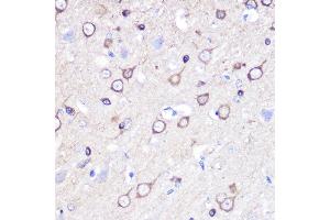 Immunohistochemistry of paraffin-embedded rat brain using Stathmin 1 Rabbit pAb (ABIN3023126, ABIN3023127, ABIN3023128 and ABIN6219402) at dilution of 1:100 (40x lens). (Stathmin 1 Antikörper  (AA 1-149))