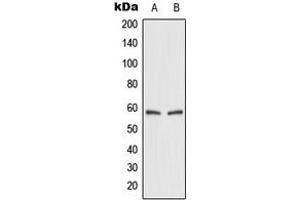 Western blot analysis of GLUT2 expression in HEK293T (A), rat kidney (B) whole cell lysates. (SLC2A2 Antikörper  (Center))