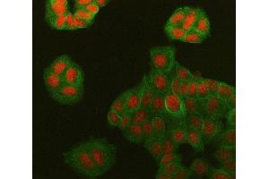 IF analysis of Symplekin/SYMPK using anti-Symplekin/SYMPK antibody (ABIN7601558) and anti-Tubulin Alpha antibody (ABIN7600339). (Symplekin Antikörper  (AA 384-1092))