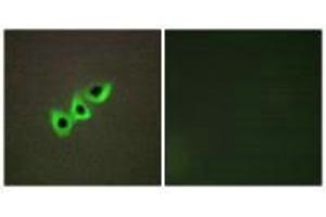 Immunofluorescence analysis of A549 cells, using RHG07 antibody. (DLC1 Antikörper)