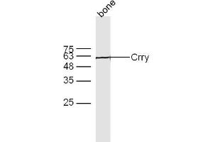 Bone lyates probed with Crry Polyclonal Antibody, Unconjugated  at 1:300 overnight at 4˚C. (CR1L Antikörper  (AA 51-150))