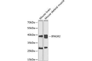 Western blot analysis of extracts of various cell lines, using IFNGR2 antibody (ABIN6134792, ABIN6142200, ABIN6142202 and ABIN6223464) at 1:1000 dilution. (IFNGR2 Antikörper  (C-Term))