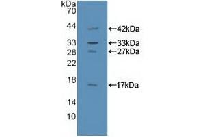 Detection of Recombinant GAB1, Human using Polyclonal Antibody to GRB2 Associated Binding Protein 1 (GAB1) (GAB1 Antikörper  (AA 394-656))
