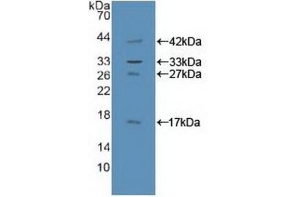 GAB1 抗体  (AA 394-656)
