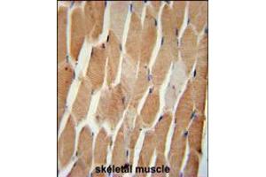 COQ7 Antibody immunohistochemistry analysis in formalin fixed and paraffin embedded human skeletal muscle followed by peroxidase conjugation of the secondary antibody and DAB staining.