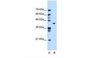 Image no. 2 for anti-Phosphoglycerate Kinase 1 (PGK1) (AA 301-350) antibody (ABIN321382) (PGK1 Antikörper  (AA 301-350))