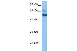 Host:  Rabbit  Target Name:  ESCO2  Sample Tissue:  Thymus Tumor lysates  Antibody Dilution:  1ug/ml (ESCO2 Antikörper  (Middle Region))