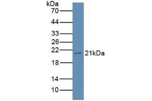 Detection of GKN3 in Rat Stomach Tissue using Polyclonal Antibody to Gastrokine 3 (GKN3)