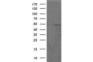 Image no. 2 for anti-Parvin, alpha (PARVA) antibody (ABIN1496445) (Parvin alpha Antikörper)