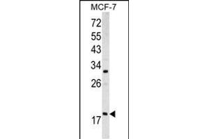 Western blot analysis of ARF3 antibody (Center D93) (ABIN390530 and ABIN2840877) in MCF-7 cell line lysates (35 μg/lane). (ARF3 Antikörper  (AA 78-106))