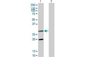 Western Blot analysis of DIABLO expression in transfected 293T cell line by DIABLO monoclonal antibody (M02), clone 4F9. (DIABLO Antikörper  (AA 119-218))