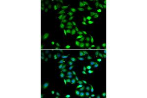 Immunofluorescence analysis of HeLa cell using PDCD6 antibody. (PDCD6 Antikörper)