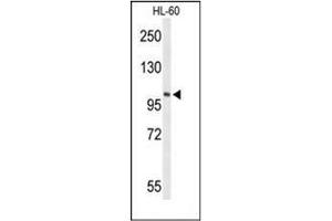 Western blot analysis of LIPE Antibody (C-term) in HL-60 cell line lysates (35ug/lane). (LIPE Antikörper  (C-Term))