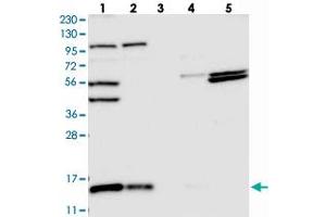 Western blot analysis of Lane 1: RT-4, Lane 2: U-251 MG, Lane 3: Human Plasma, Lane 4: Liver, Lane 5: Tonsil with FAM136A polyclonal antibody  at 1:250-1:500 dilution. (FAM136A Antikörper)