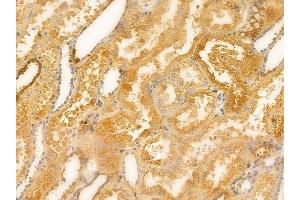 anti-G Protein-Coupled Receptor 148 (GPR148) antibody
