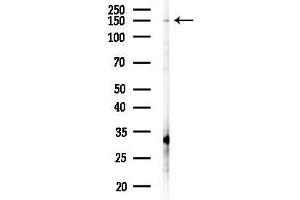 anti-CCCTC-Binding Factor (Zinc Finger Protein) (CTCF) (C-Term) antibody