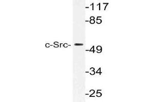 Western blot (WB) analysis of c-Src antibody in extracts from HeLa cells. (NCOA1 Antikörper)