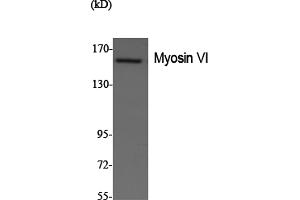 Western Blotting (WB) image for anti-Myosin VI (MYO6) antibody (ABIN5958676) (Myosin VI Antikörper)
