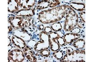 Immunohistochemistry (IHC) image for anti-Induced Myeloid Leukemia Cell Differentiation Protein Mcl-1 (MCL1) antibody (ABIN1499341) (MCL-1 Antikörper)