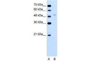 WB Suggested Anti-FECH  Antibody Titration: 0. (FECH Antikörper  (N-Term))