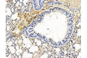 ABIN7096583 and ABIN7100647 at 1/100 staining mouse lung tissue by IHC-P. (RUFY3 Antikörper)