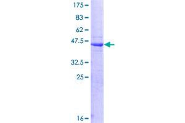 HPS1 Protein (AA 1-194) (GST tag)