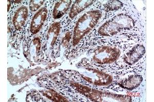 Immunohistochemical analysis of paraffin-embedded human-colon, antibody was diluted at 1:100. (FOXP3 Antikörper  (C-Term))