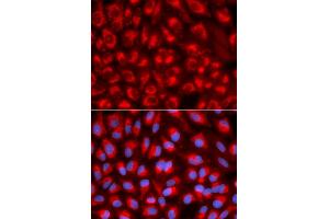 Immunofluorescence analysis of U2OS cells using TFAM antibody (ABIN5970991). (TFAM Antikörper)