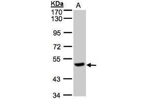 WB Image Sample(30 μg of whole cell lysate) A:Raji, 7. (CPQ Antikörper)