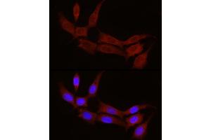 Immunofluorescence analysis of NIH/3T3 cells using STX17 Rabbit pAb (ABIN7270682) at dilution of 1:100 (40x lens). (Syntaxin 17 Antikörper  (AA 1-130))